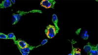 Microscope image of lung tissue samples